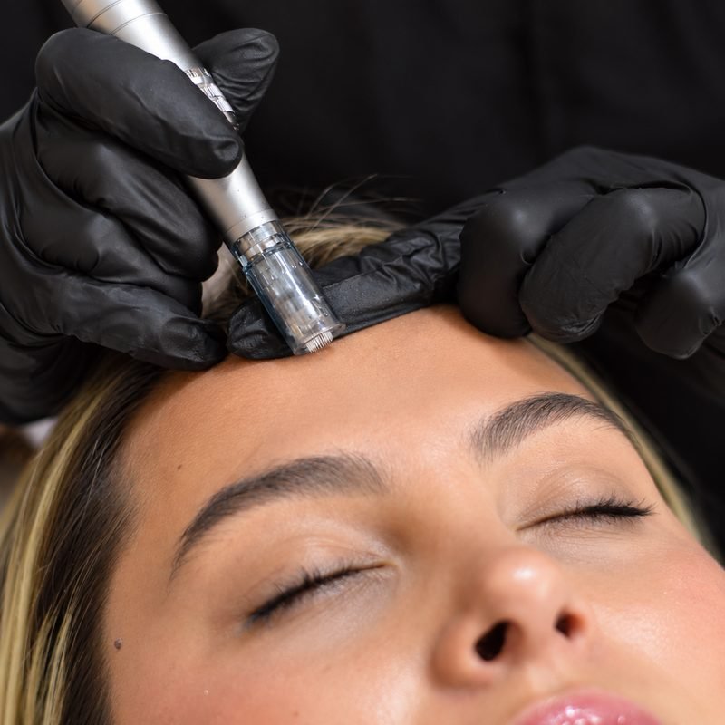 Valoración dermatológica en Radiantez, Pasto